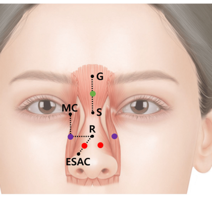 Nasal Pattern and Wrinkle
